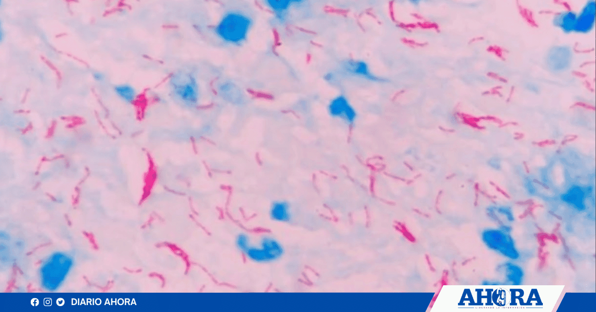 Bacterias resistentes ponen en jaque la salud pública en Perú