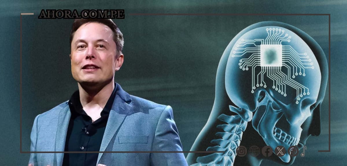 Elon Musk anuncia el primer implante exitoso de un chip cerebral en humano por Neuralink