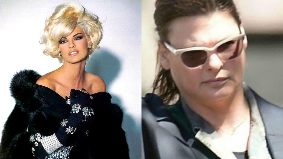Al someterse a un procedimiento cosmético 'Linda Evangelista' resultó deformada