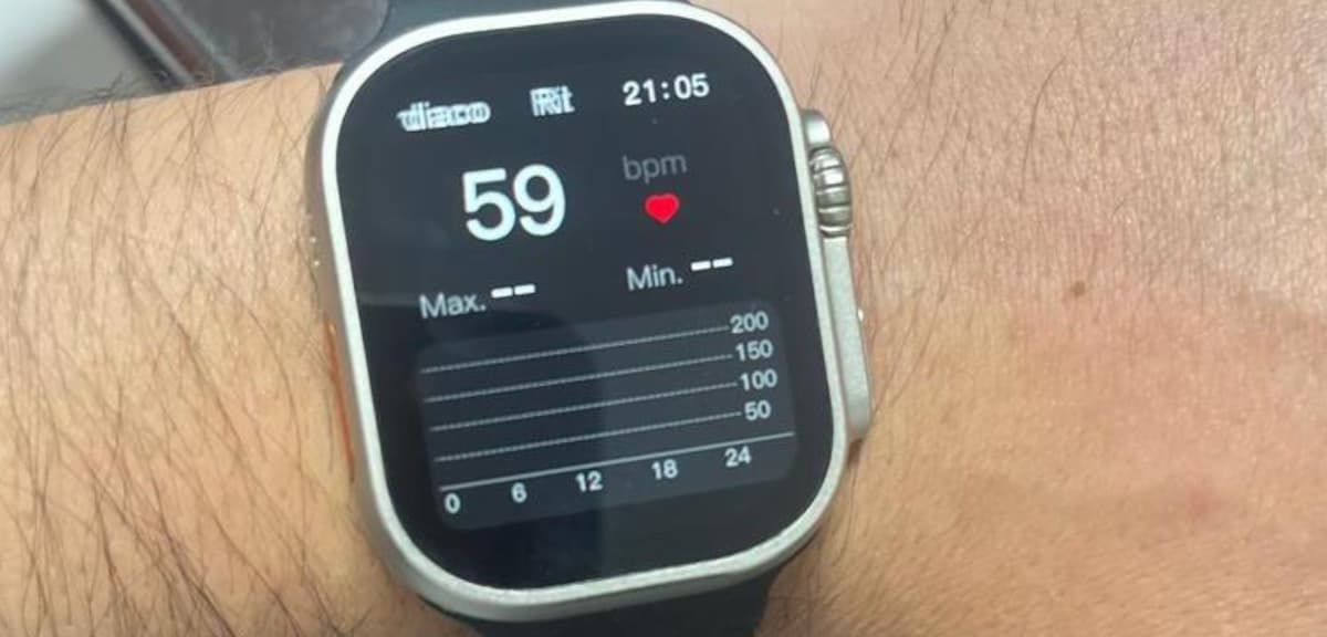 Relojes Inteligentes: Herramientas Potenciales para la Detección Temprana de Parkinson