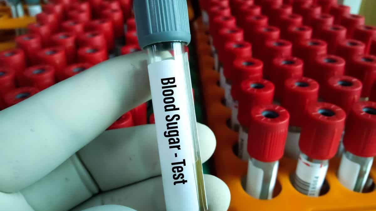 HbA1c: Test de diabetes confunde diagnóstico en población india