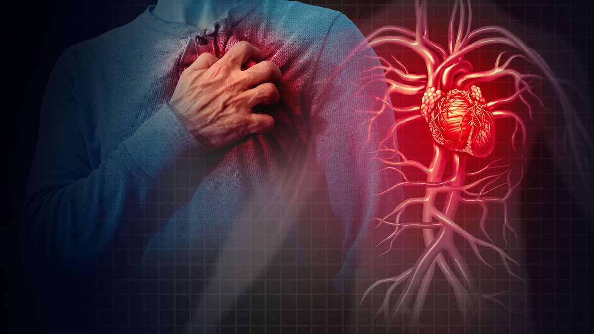 Conoce los síntomas de los triglicéridos y el colesterol alto
