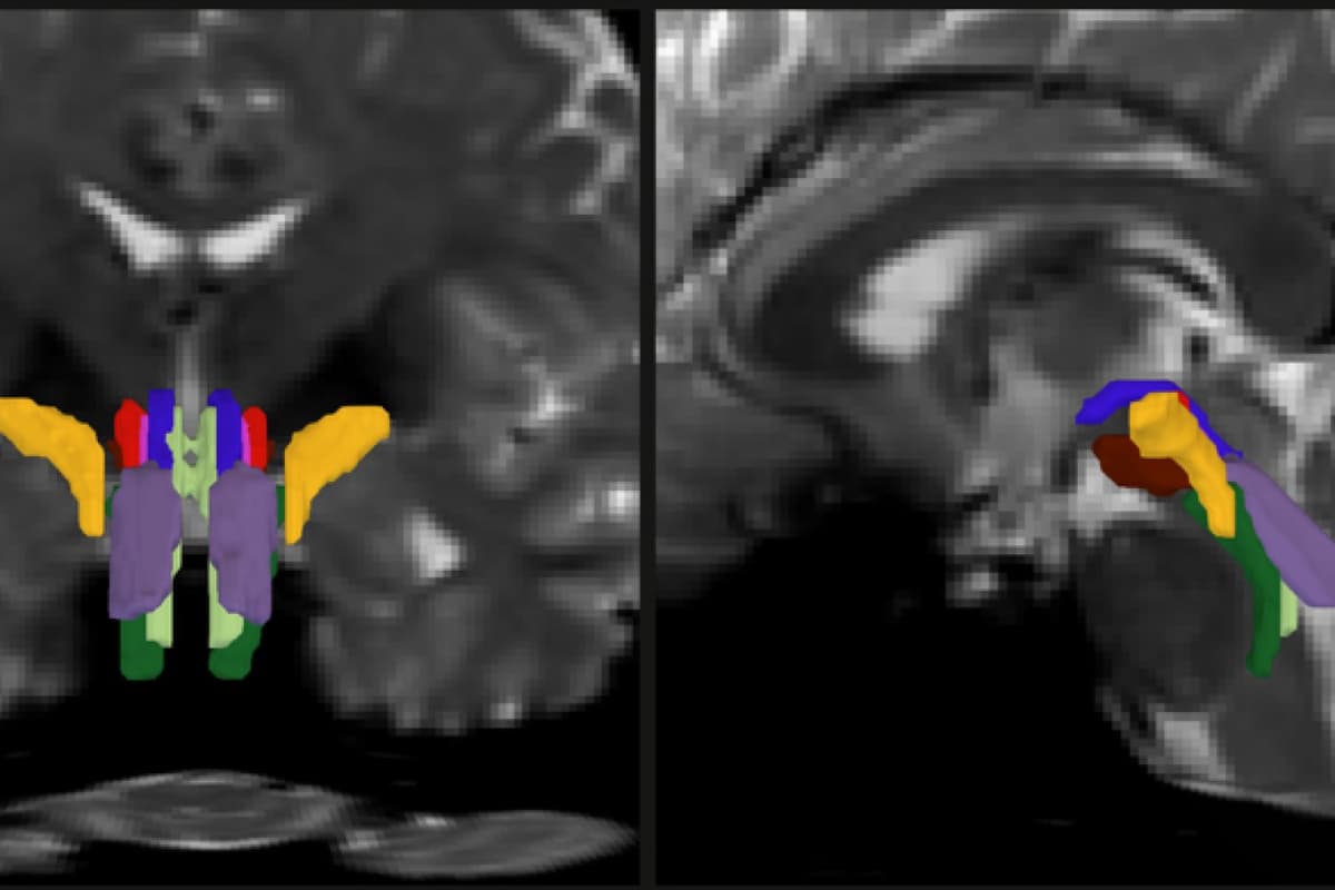 IA mapea caminos vitales del cerebro