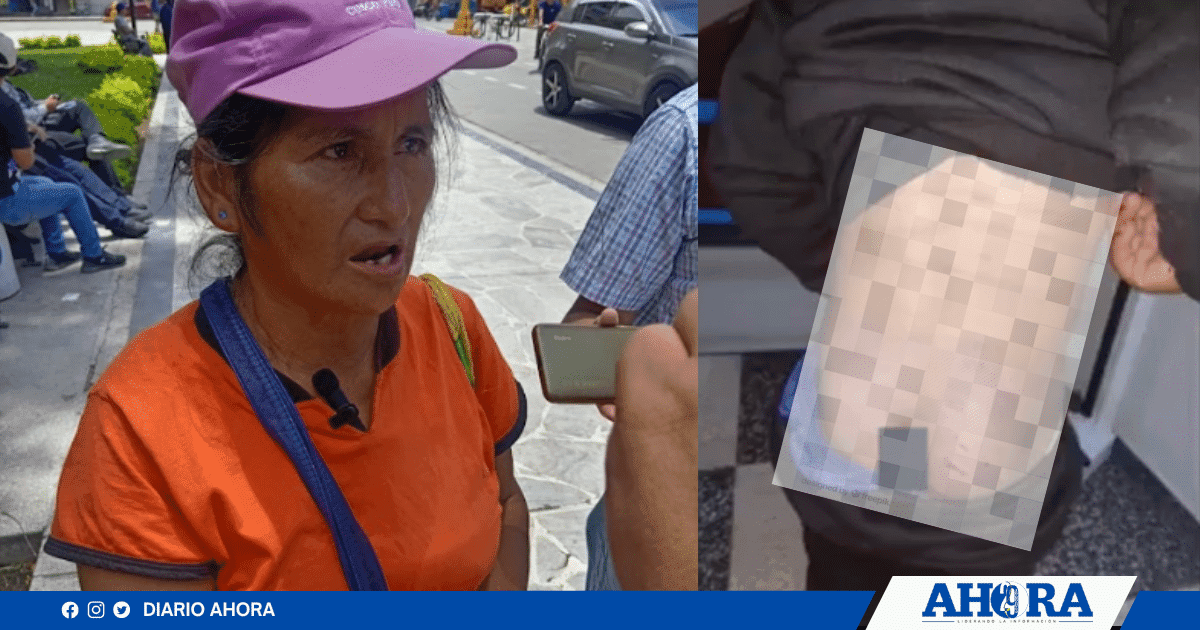 Tres personas adultas flagelaron y golpearon salvajemente a un niño de 12 años en Santo Domingo de Nauyan