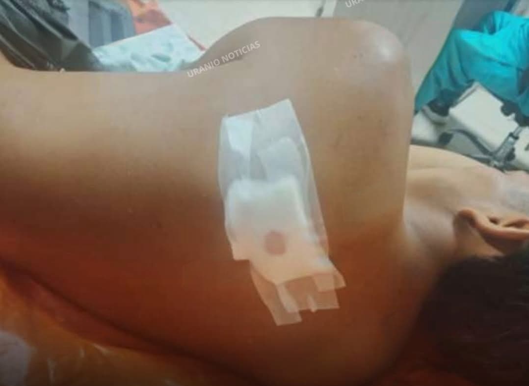Ataque en Supte San Jorge: menor de 17 queda grave tras presunto intento de robo en Tingo María