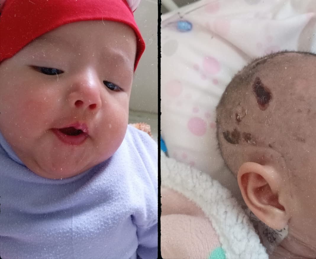 Bebé queda postrada tras cirugía cerebral y madre denuncia negligencia médica
