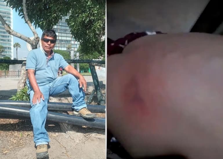 Denuncian a padre por presunta golpiza a su hija de dos años en Macuya