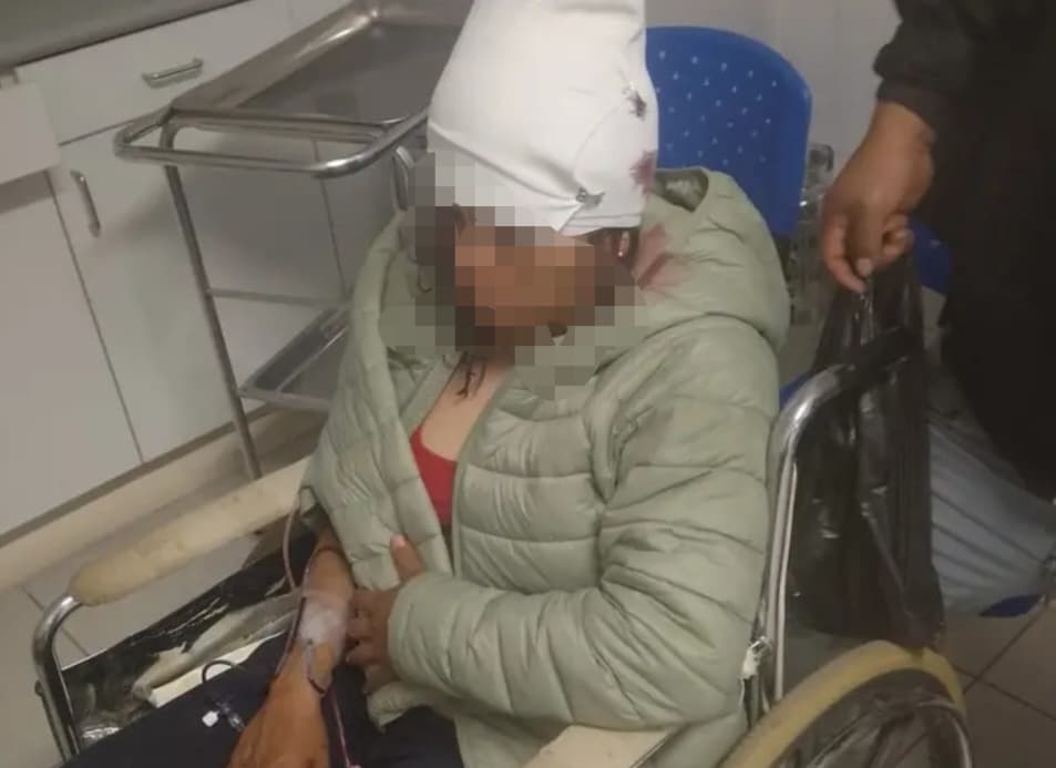 Policía queda herida tras caer motofurgón a una pendiente en Chupán