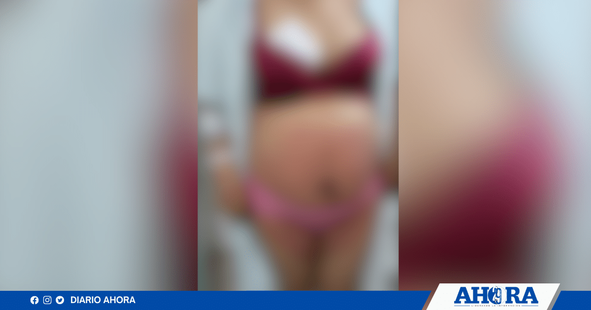 Denuncian presunta negligencia en EsSalud: Madre e hija afectadas tras complicado proceso de parto